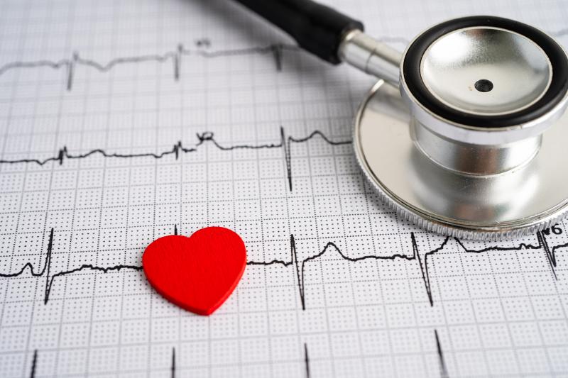 Stethoscope on electrocardiogram ECG with red heart, heart wave, heart attack, cardiogram report.